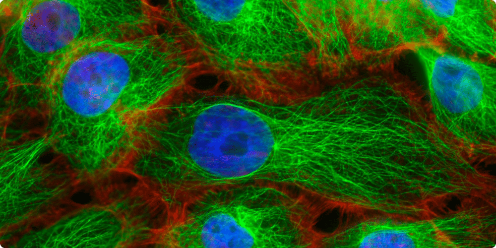 Évolutions technologiques des microscopes à fluorescence